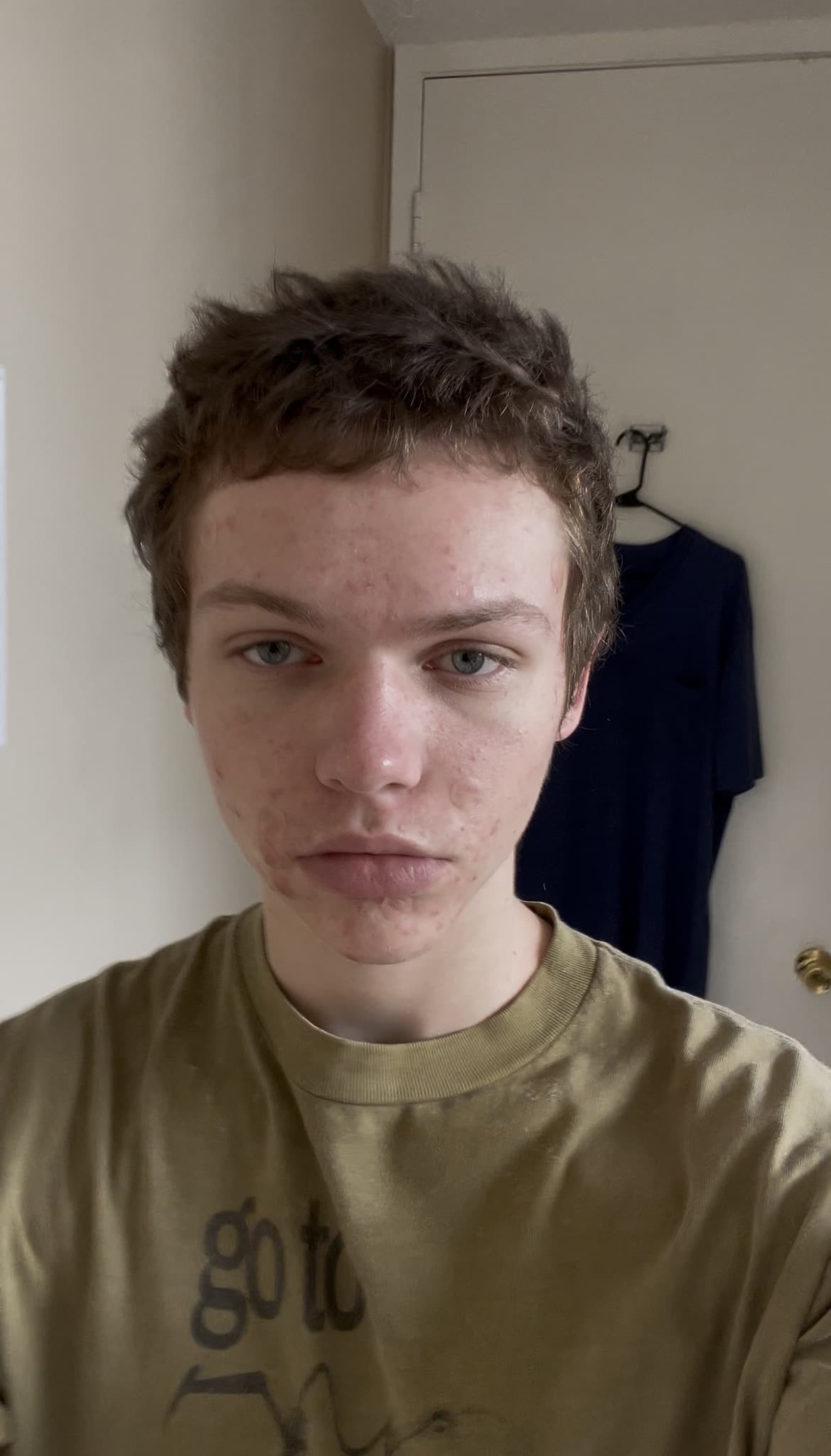 Thread image