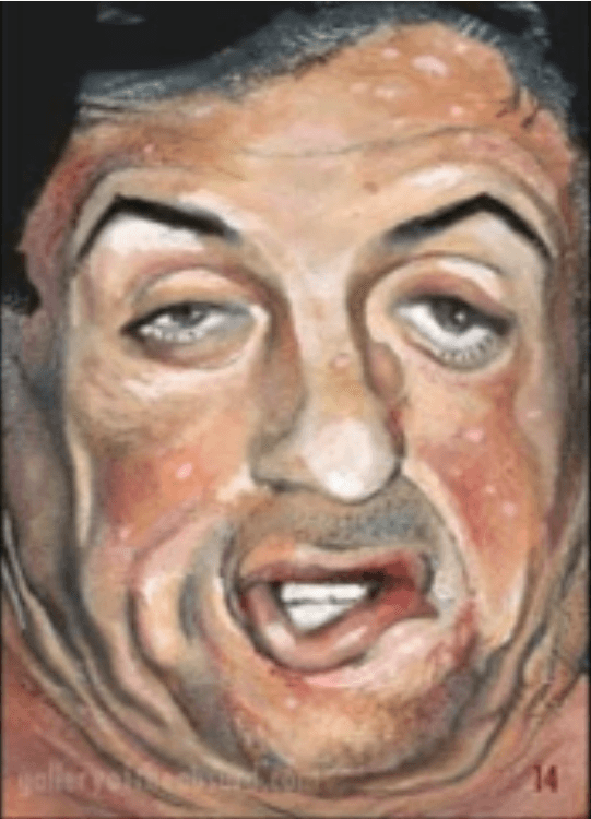 Thread image