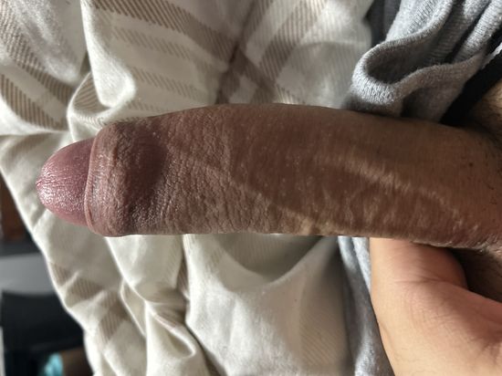 Thread image