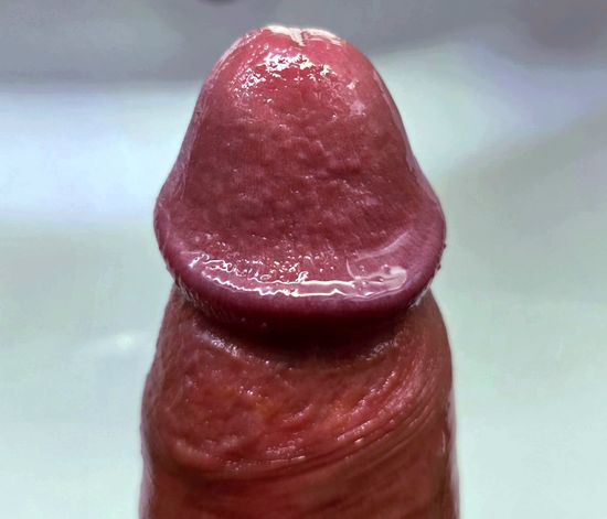Thread image