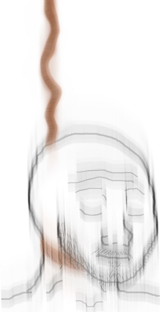 Thread image