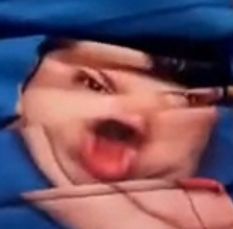 Thread image